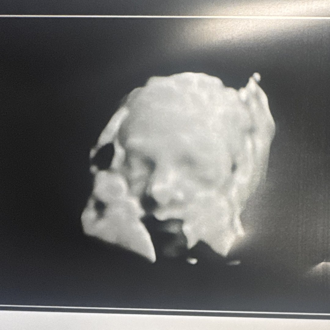 Photo shared by Kimberly for their Babylist baby registry.