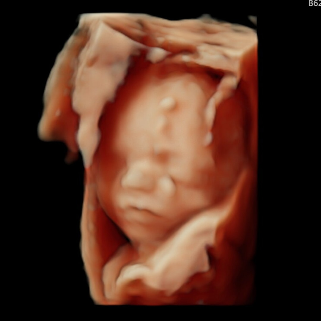 Photo shared by Grace for their Babylist baby registry.