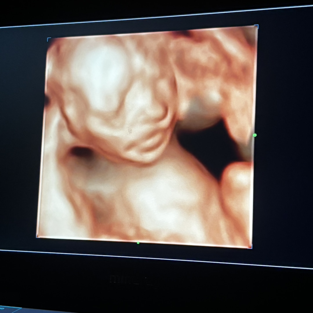 Photo shared by Luz for their Babylist baby registry.