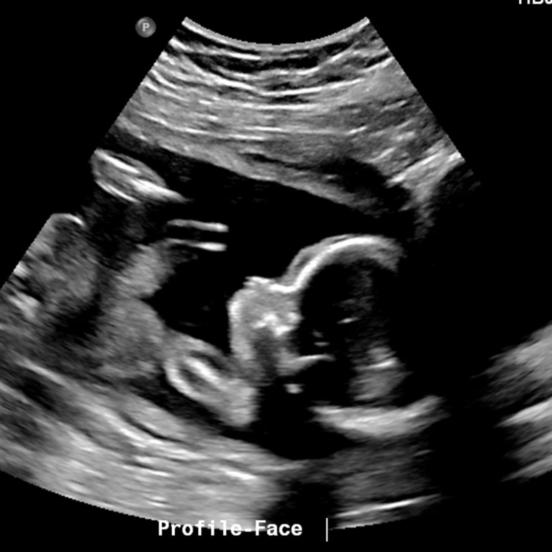 Photo shared by Kristi for their Babylist baby registry.