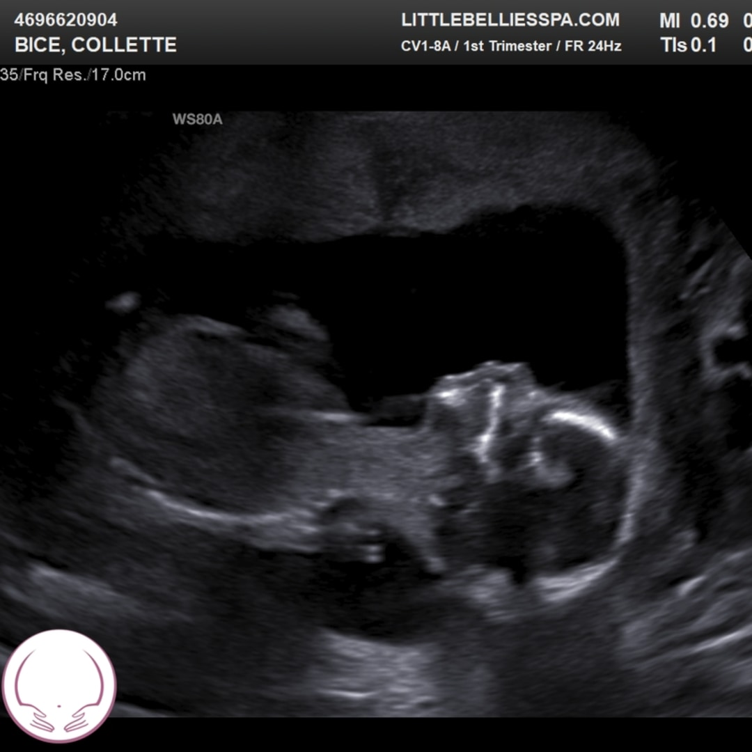 Photo shared by Collette for their Babylist baby registry.