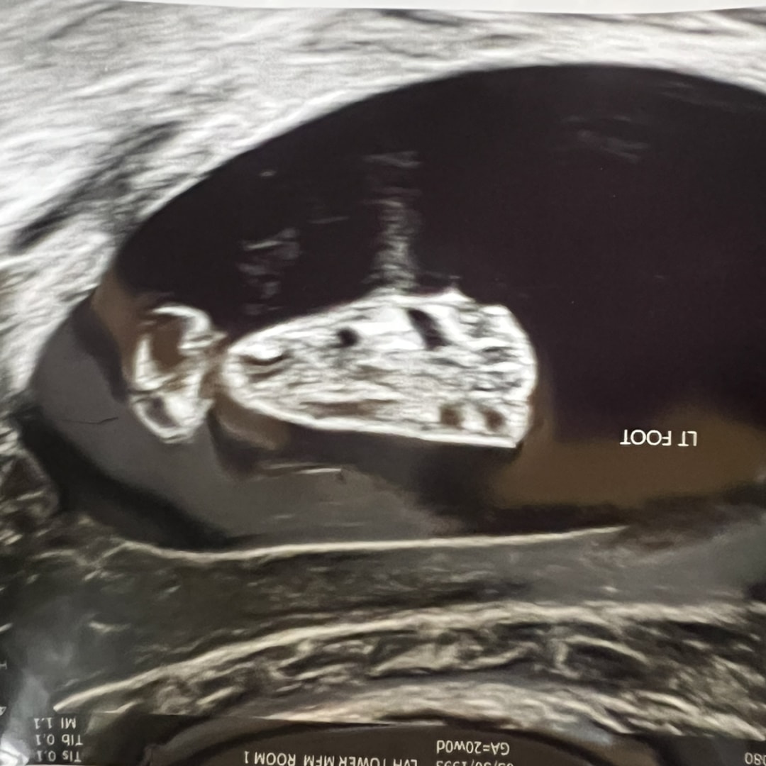 Photo shared by Jess for their Babylist baby registry.