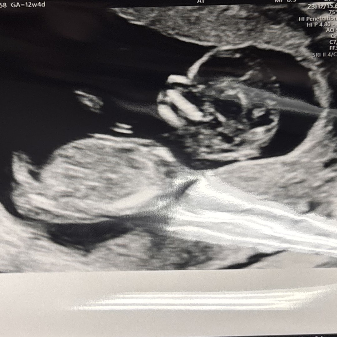 Photo shared by Amanda for their Babylist baby registry.