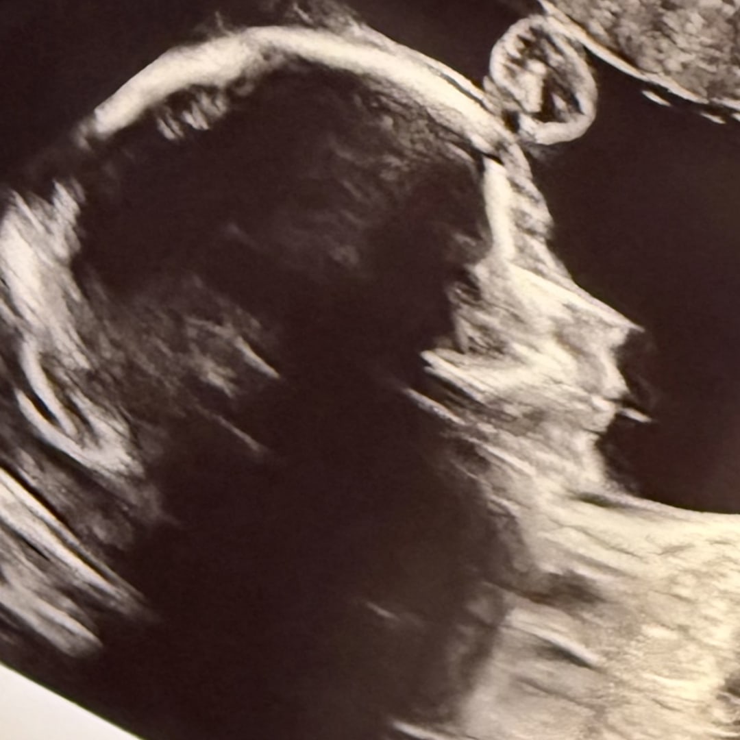 Photo shared by Kyra for their Babylist baby registry.