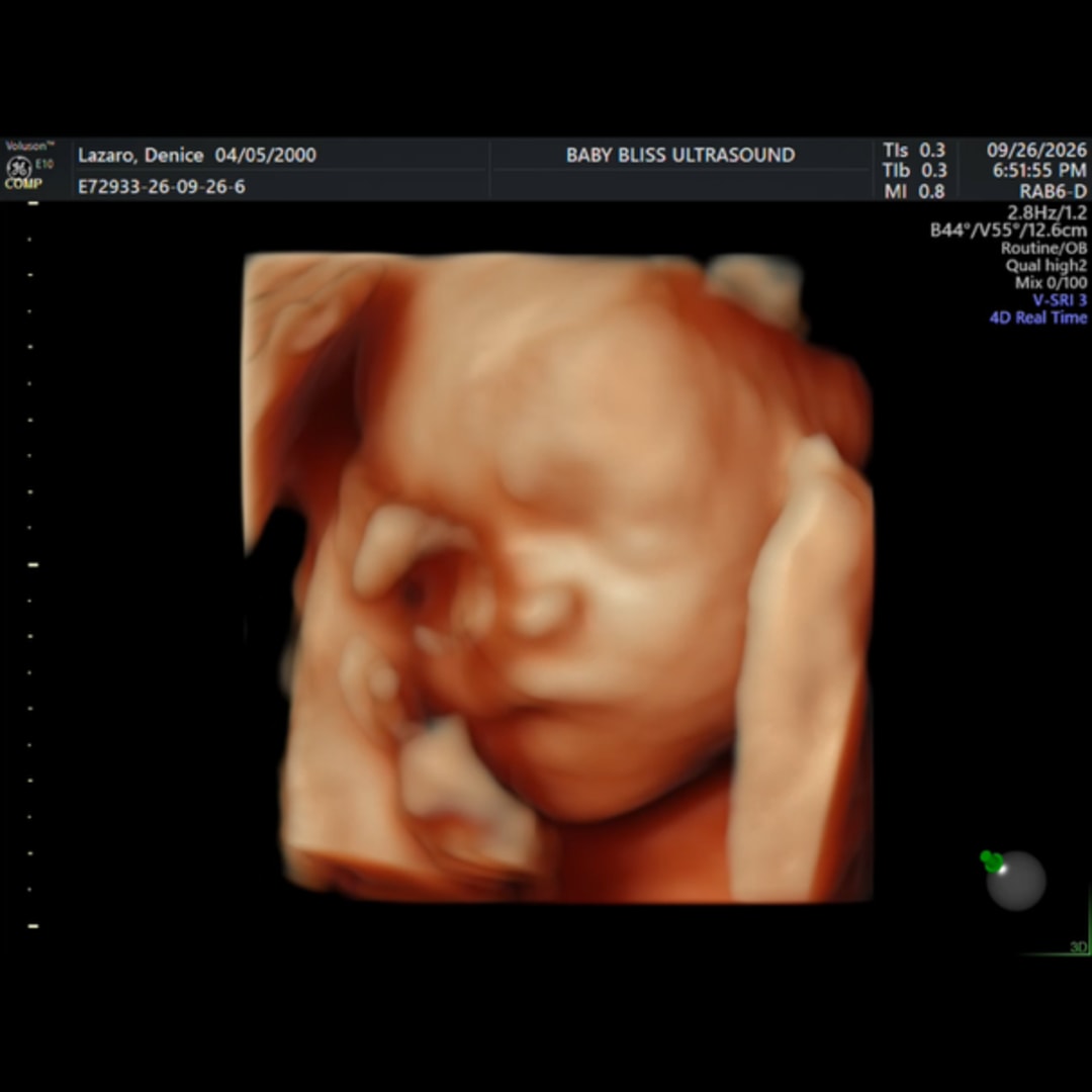 Photo shared by Denice for their Babylist baby registry.