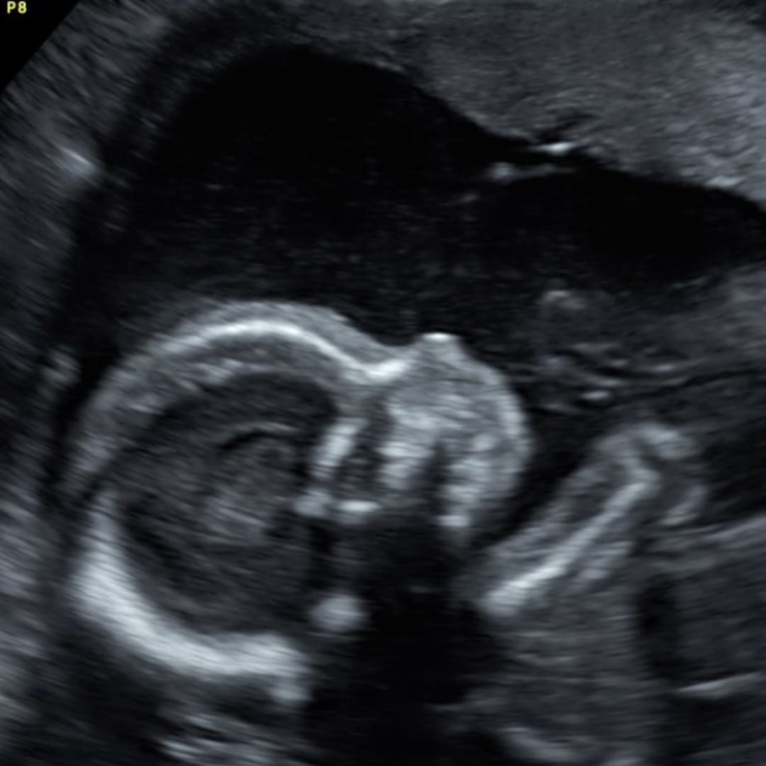 Photo shared by Sydney for their Babylist baby registry.