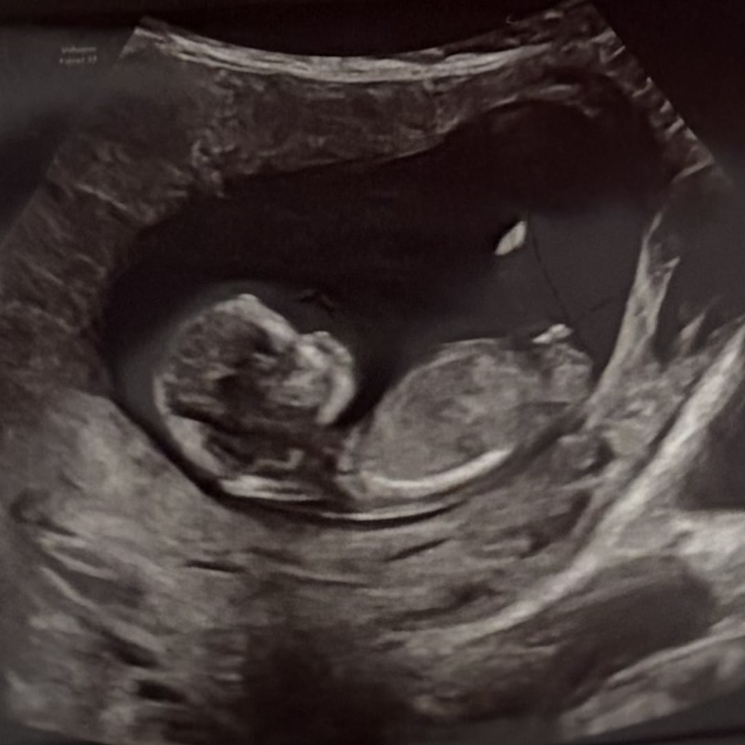 Photo shared by Katie for their Babylist baby registry.