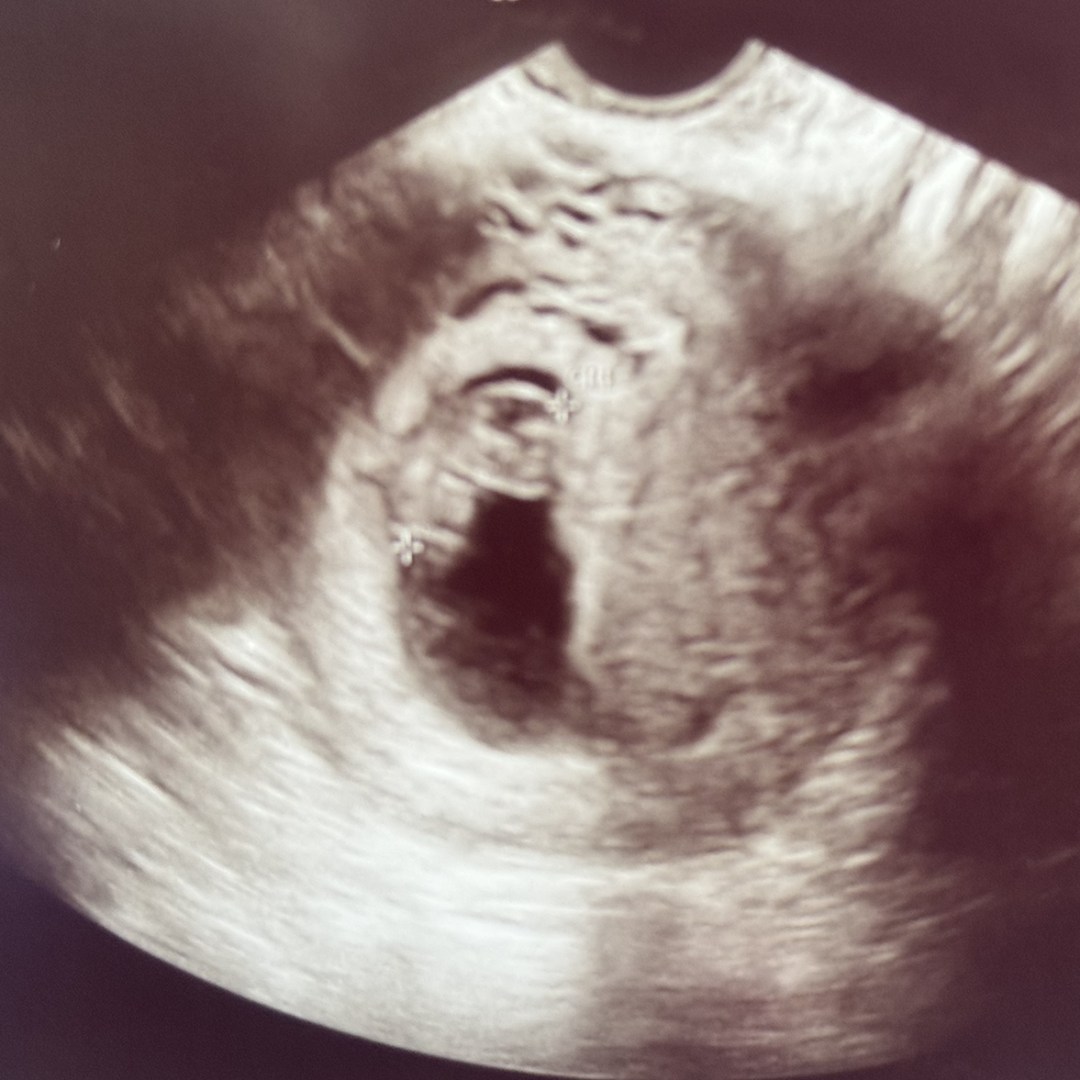 Photo shared by Madelynn for their Babylist baby registry.