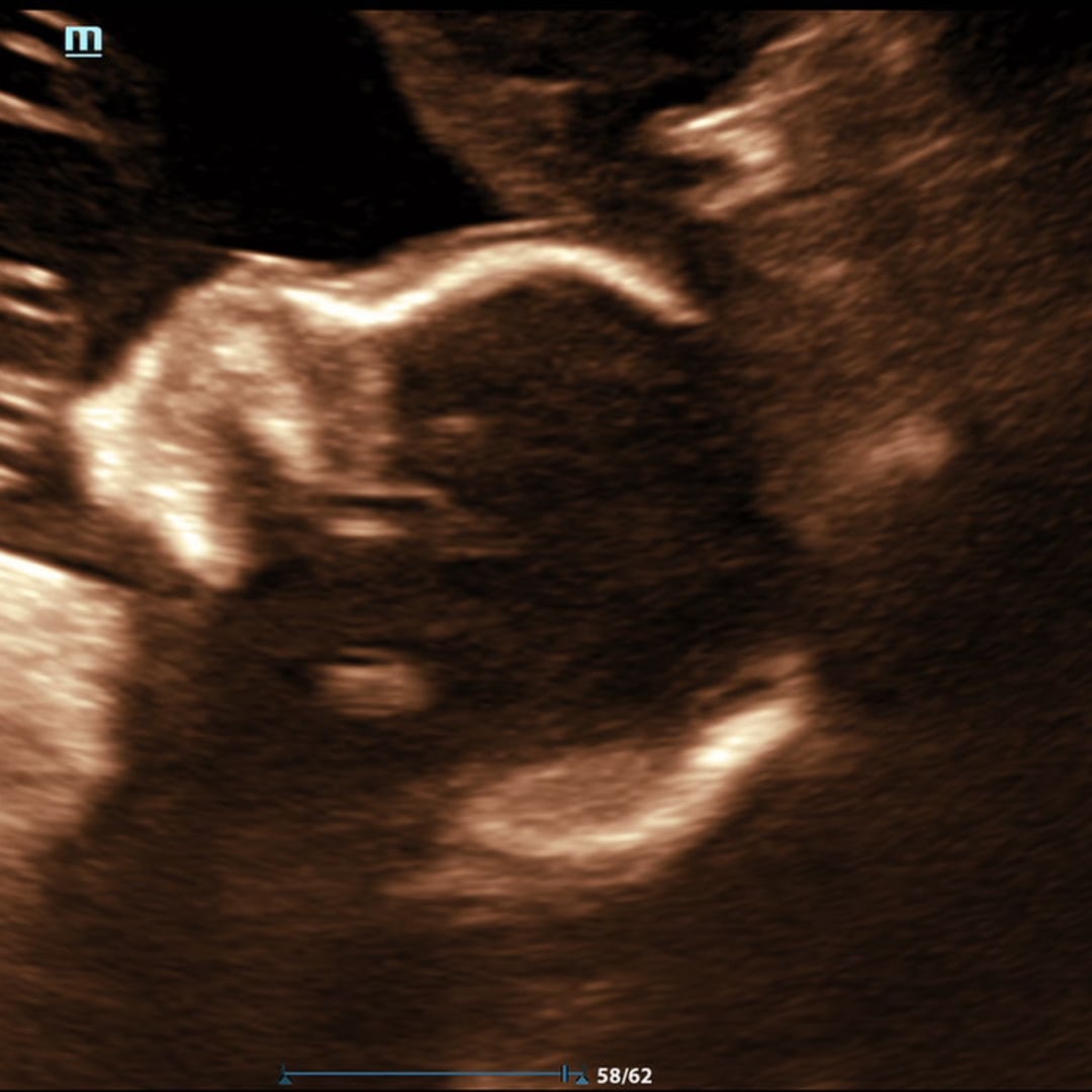 Photo shared by Ava for their Babylist baby registry.
