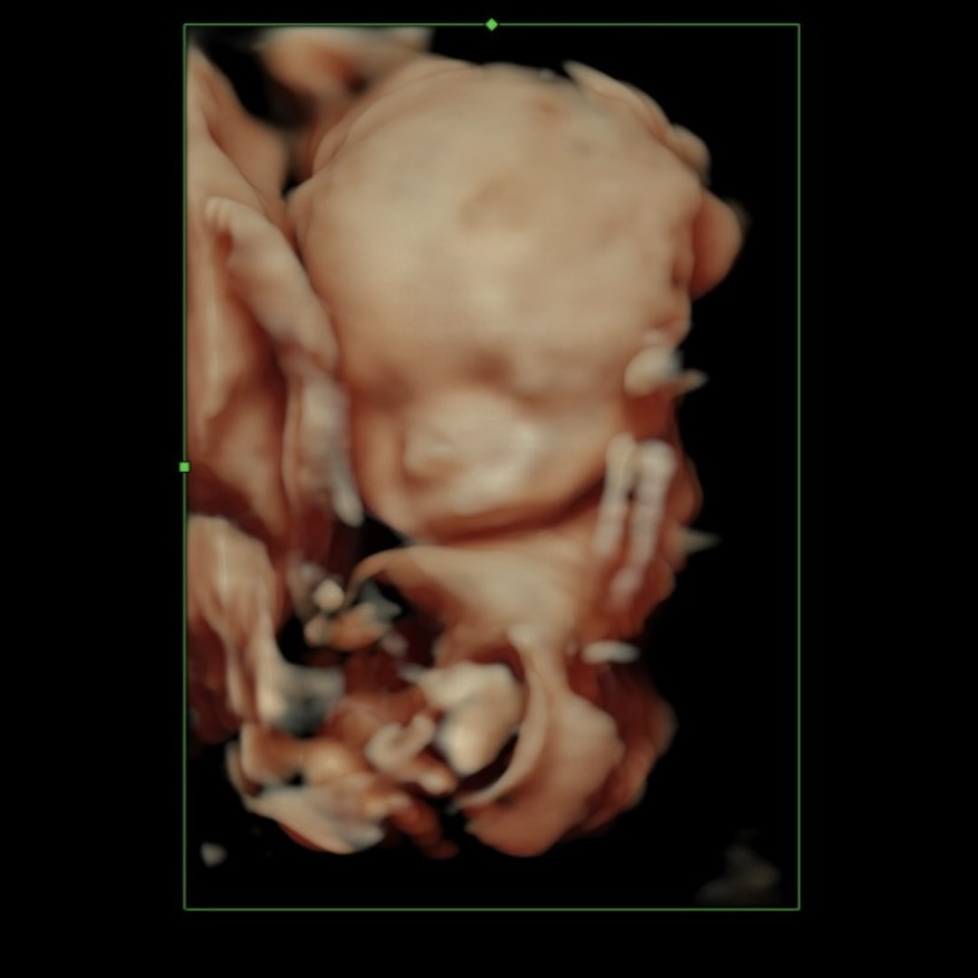 Photo shared by Allison for their Babylist baby registry.