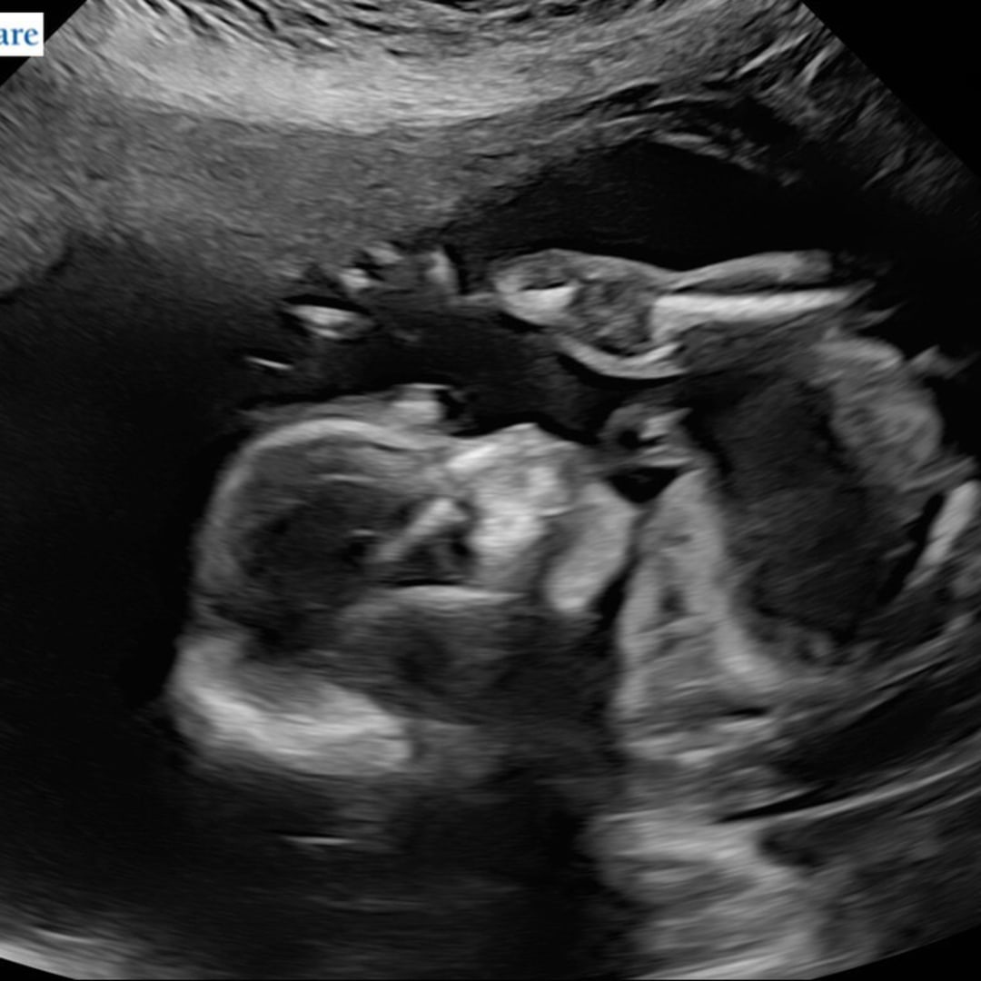 Photo shared by Emily for their Babylist baby registry.