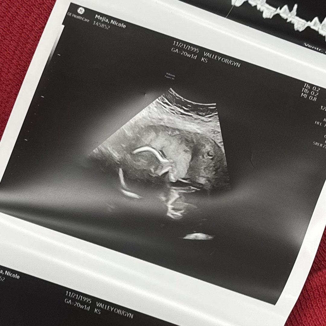 Photo shared by Nikki for their Babylist baby registry.