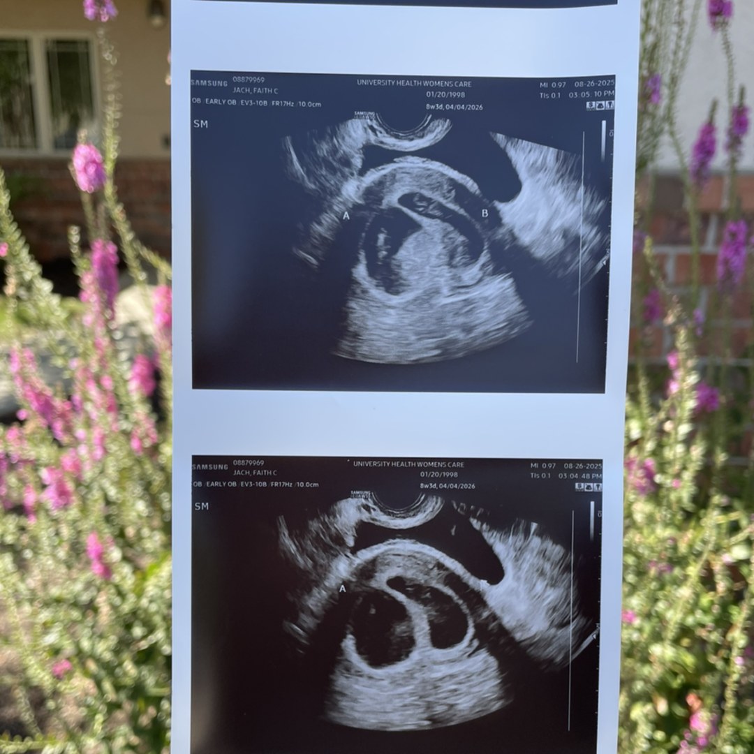 Photo shared by Faith for their Babylist baby registry.