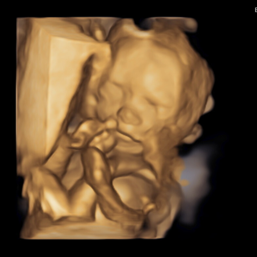 Photo shared by Hailee for their Babylist baby registry.