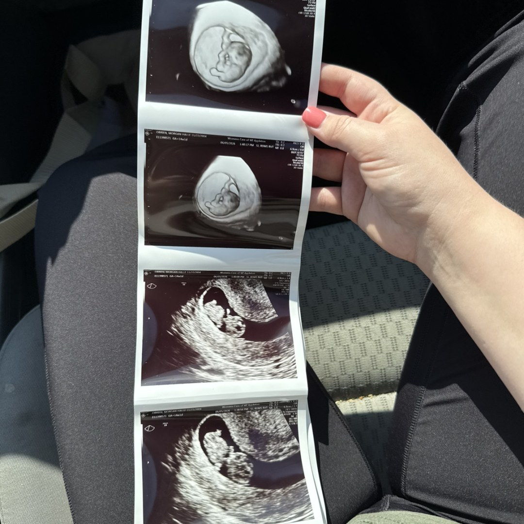Photo shared by Morgan for their Babylist baby registry.