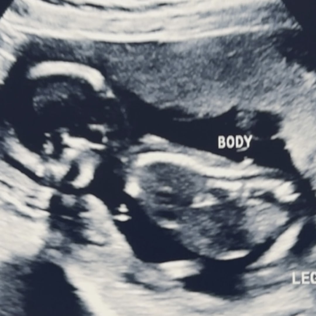 Photo shared by Brittany for their Babylist baby registry.