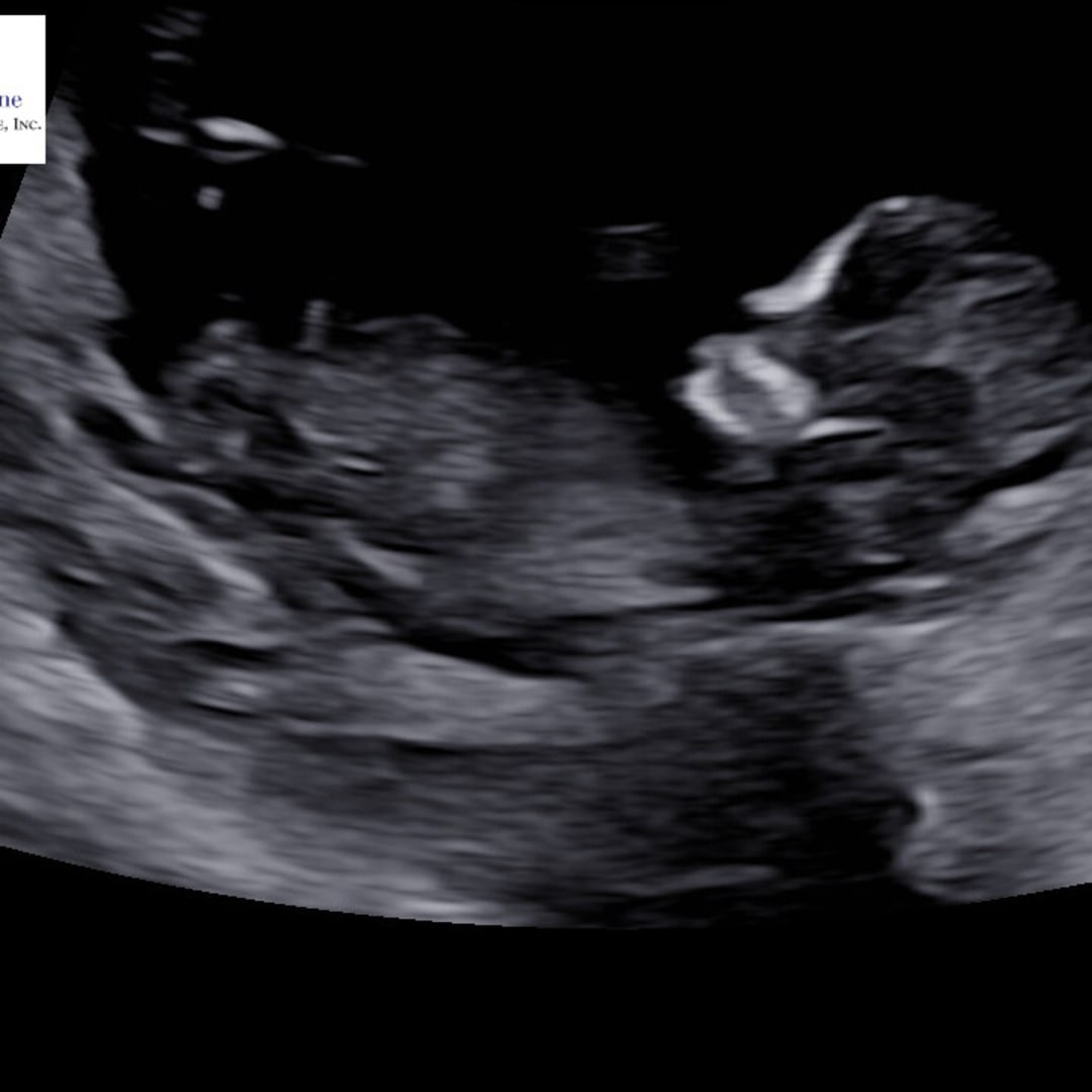 Photo shared by Alexis for their Babylist baby registry.