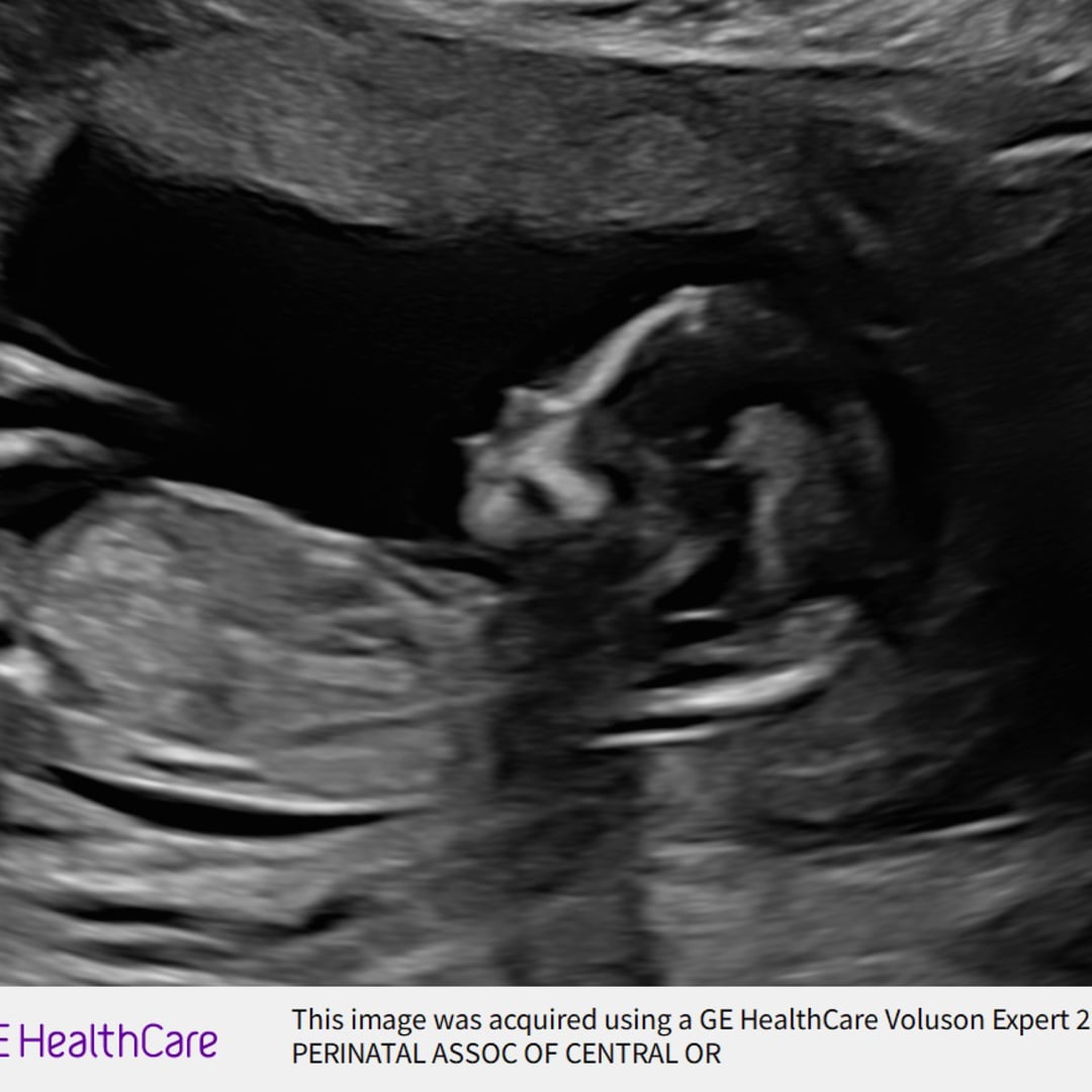 Photo shared by Breanna for their Babylist baby registry.