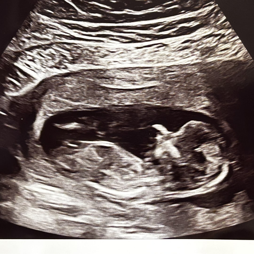 Photo shared by Nina for their Babylist baby registry.