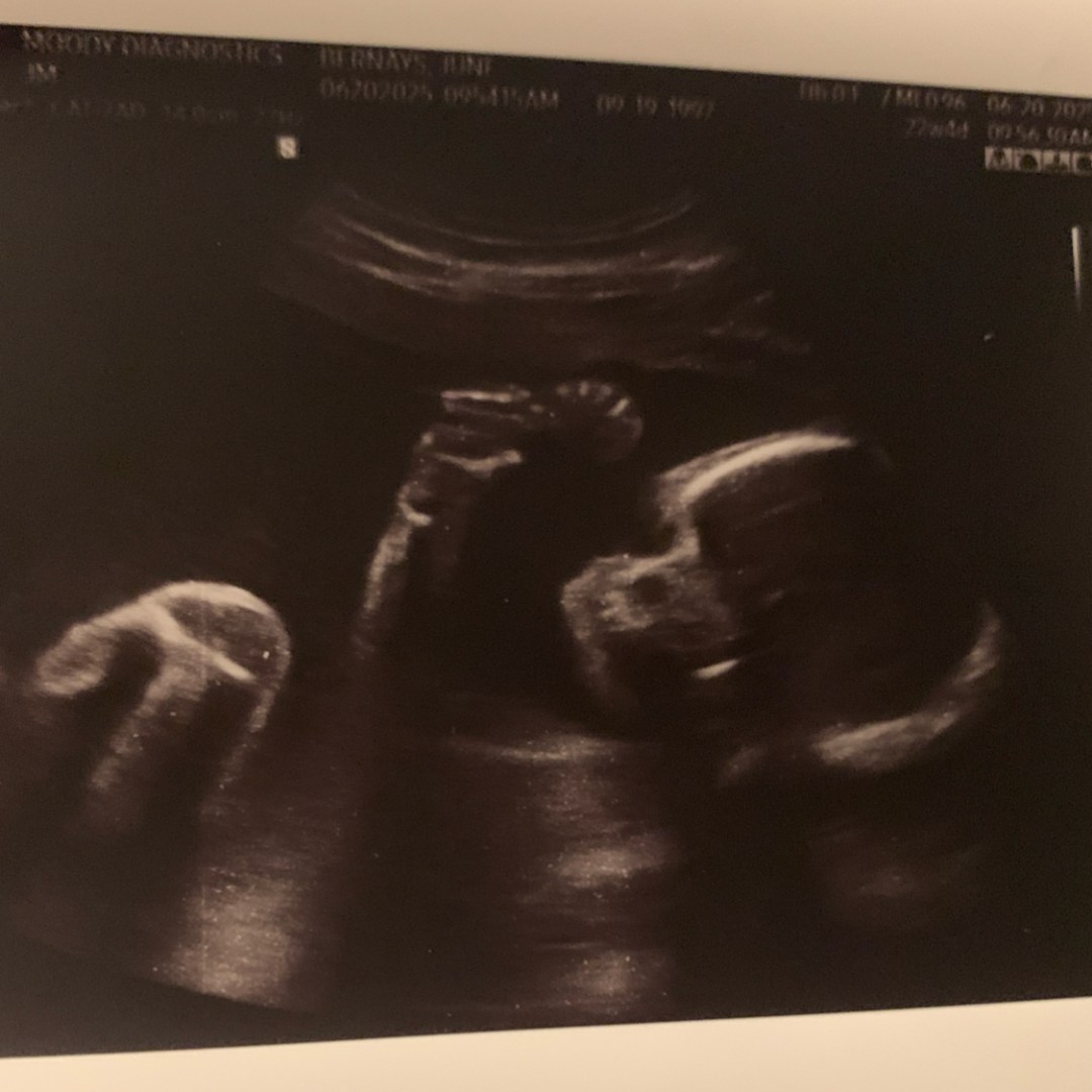 Photo shared by June for their Babylist baby registry.