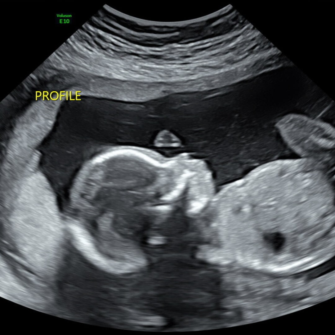 Photo shared by Tateana for their Babylist baby registry.