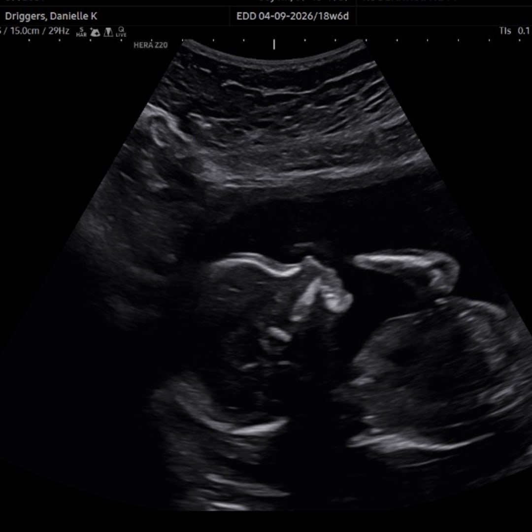 Photo shared by Danielle for their Babylist baby registry.