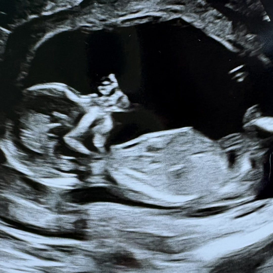 Photo shared by Adrialis for their Babylist baby registry.