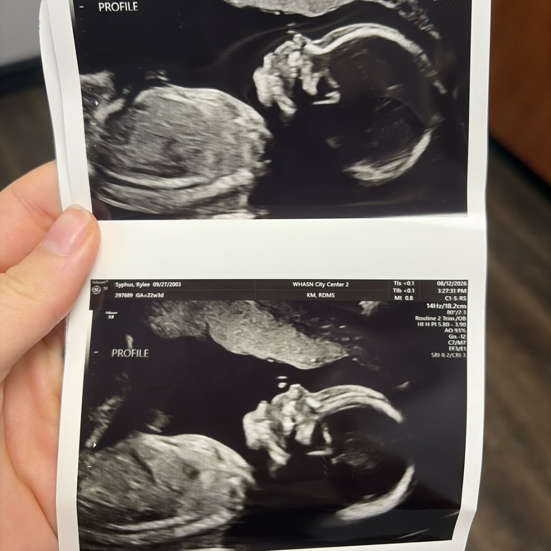 Photo shared by Rylee for their Babylist baby registry.