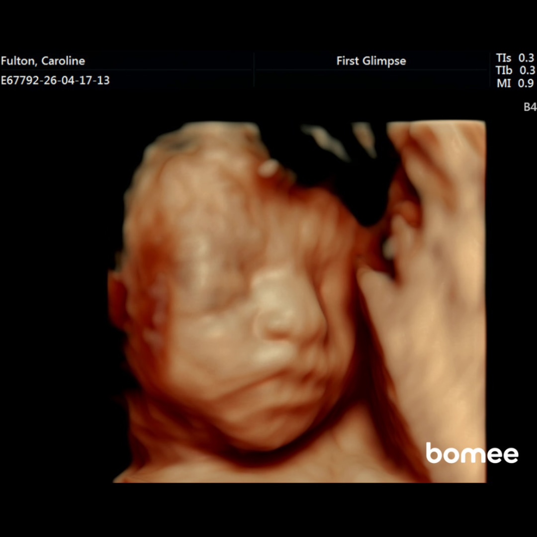 Photo shared by Caroline for their Babylist baby registry.