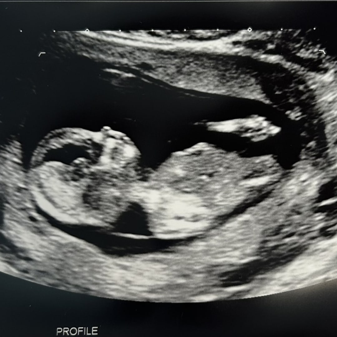Photo shared by Kayla for their Babylist baby registry.