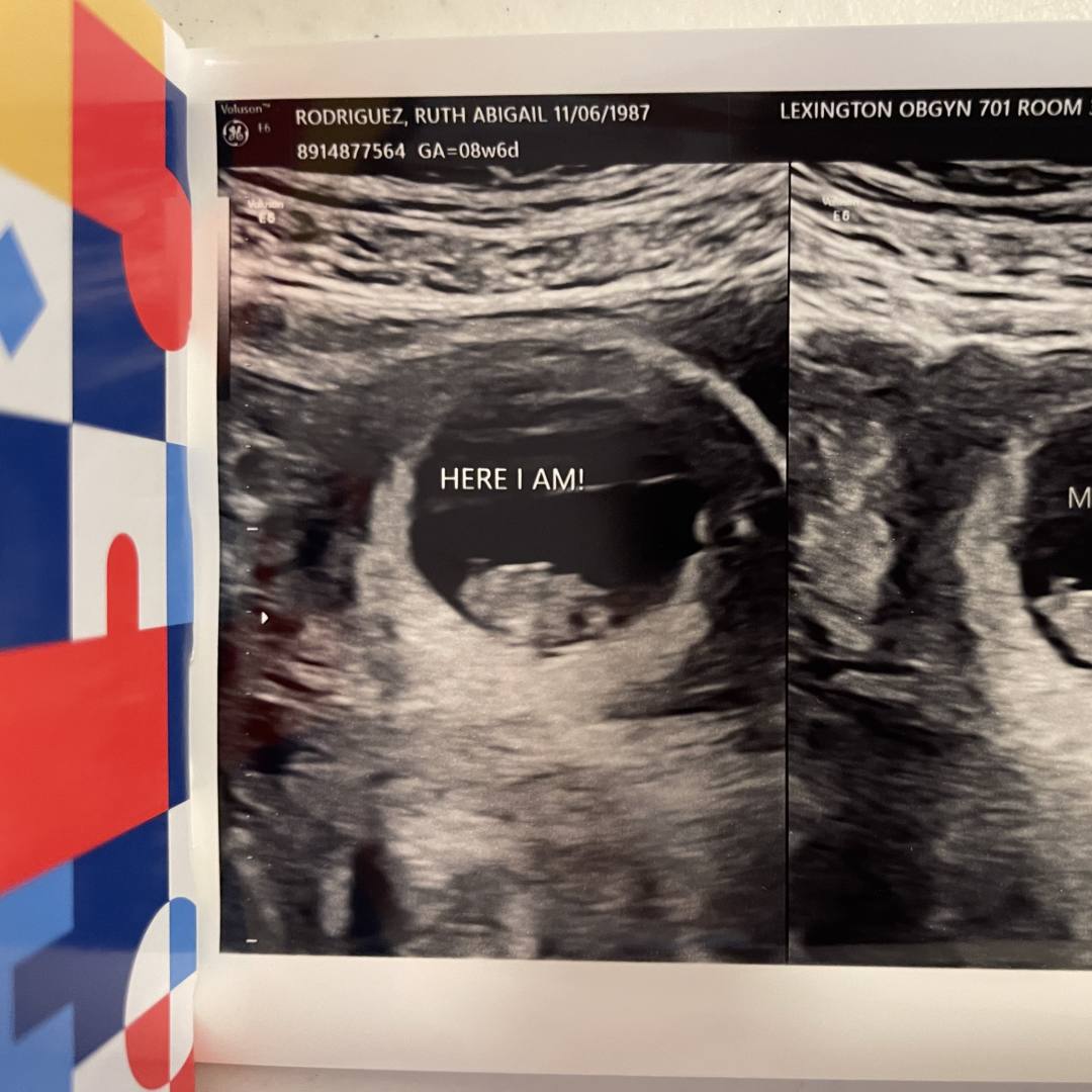 Photo shared by Ruth for their Babylist baby registry.