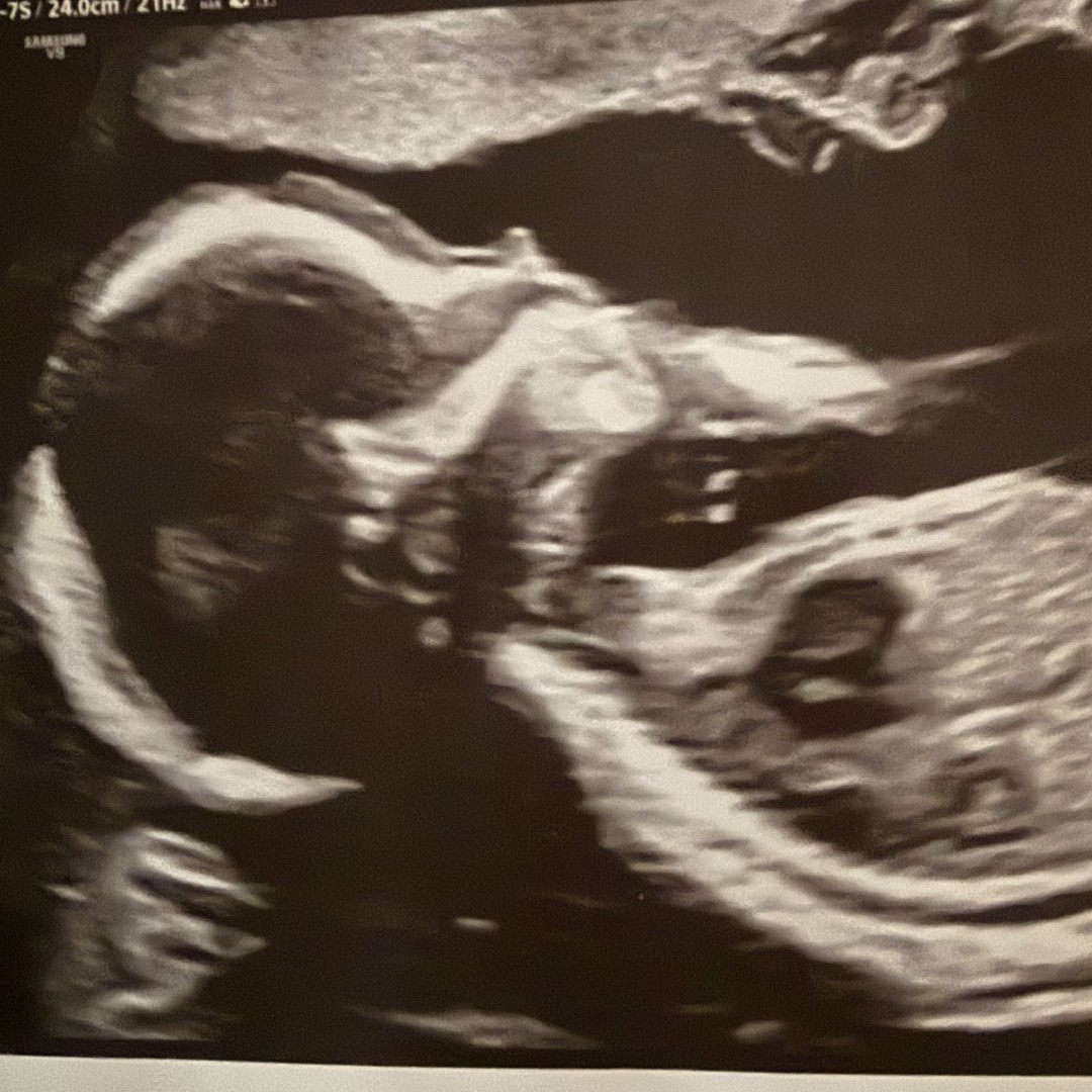 Photo shared by Rachel for their Babylist baby registry.