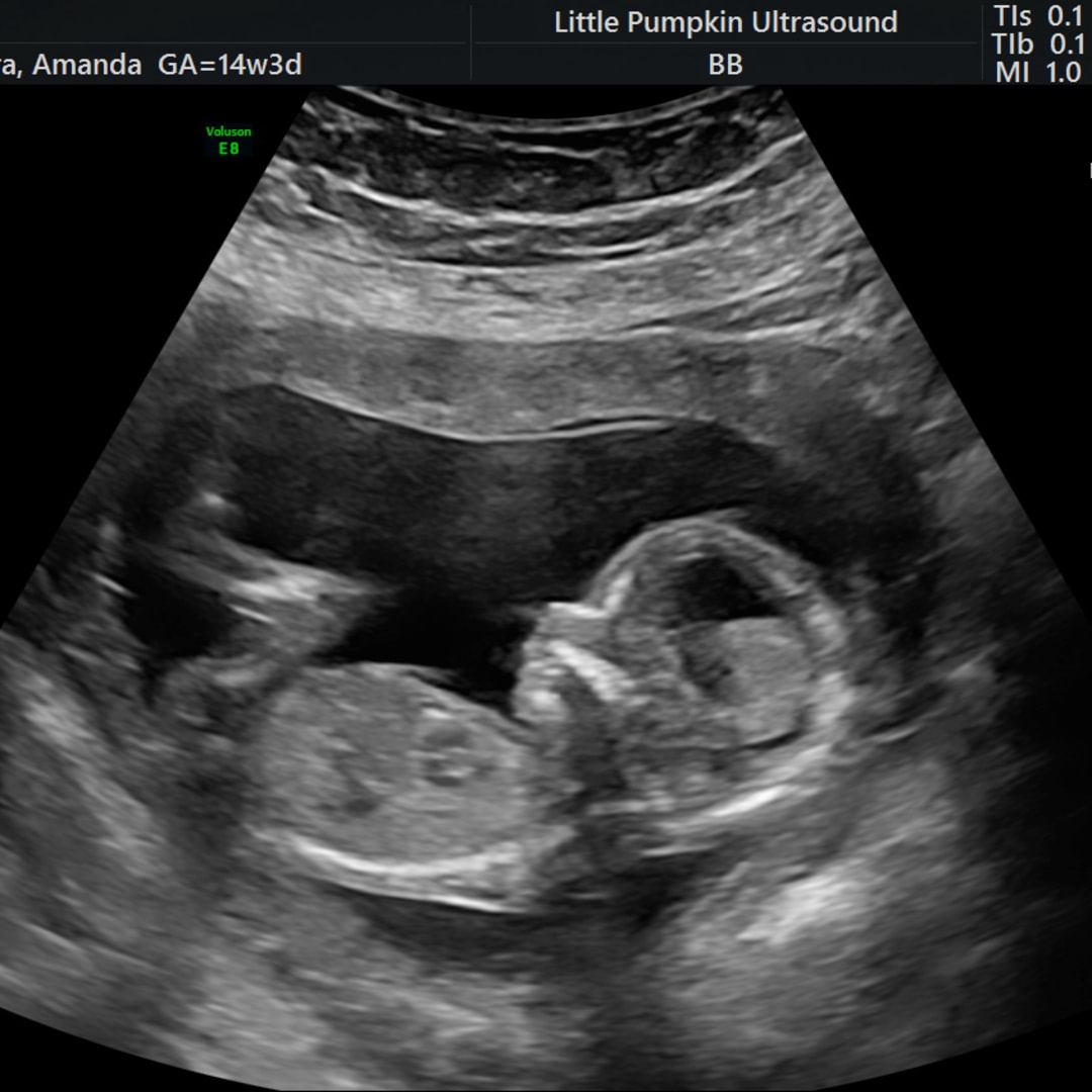 Photo shared by Amanda for their Babylist baby registry.