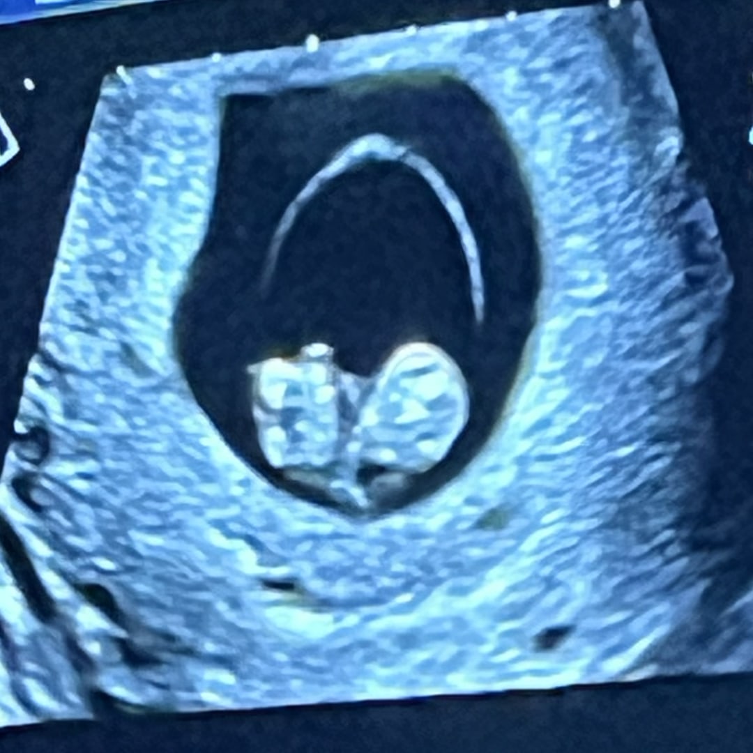 Photo shared by Cheyanne for their Babylist baby registry.
