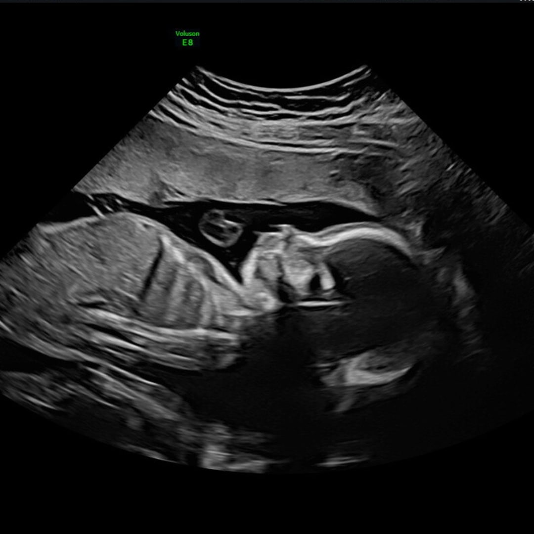 Photo shared by Savannah for their Babylist baby registry.