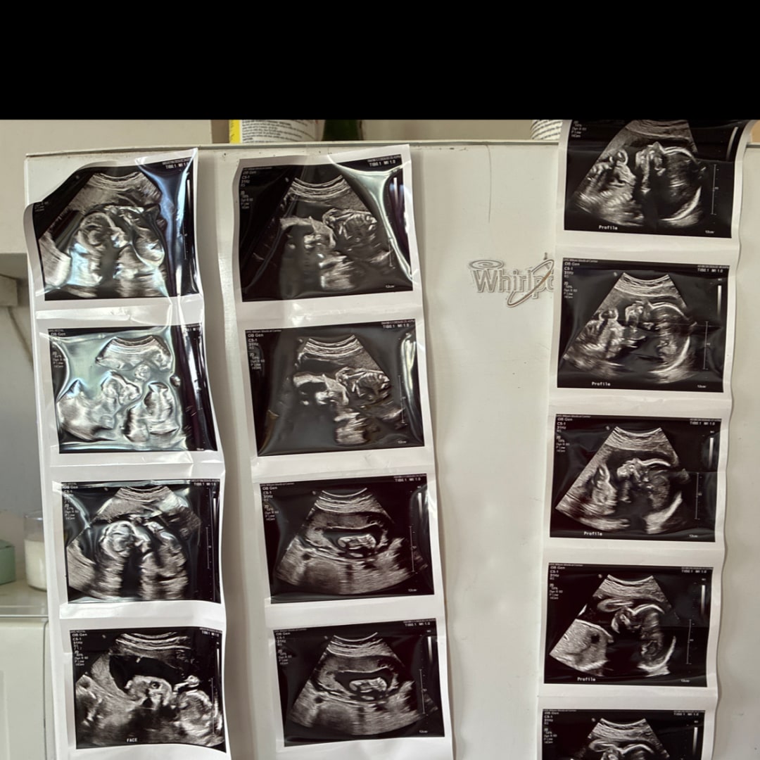 Photo shared by Hilda for their Babylist baby registry.