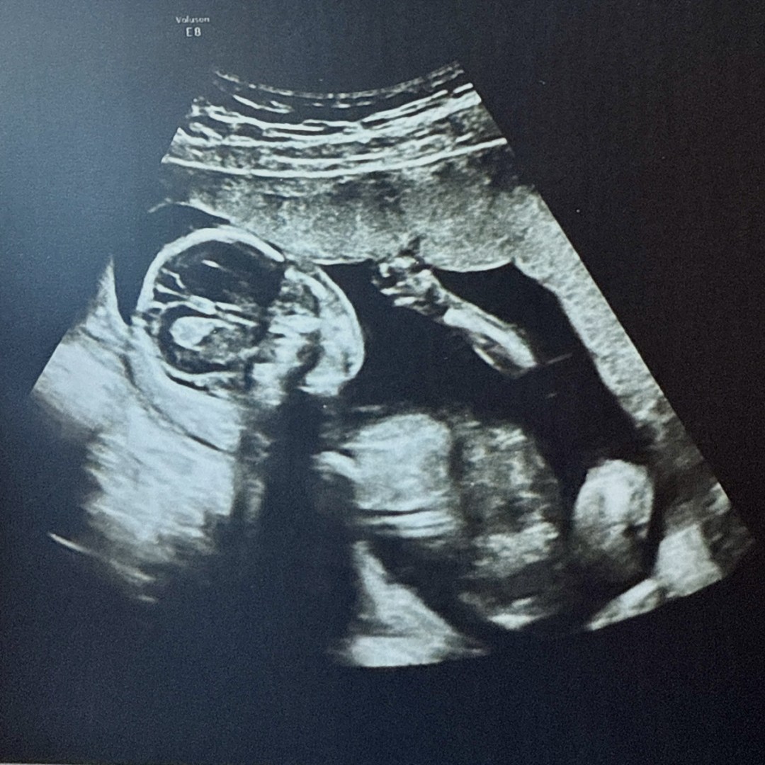 Photo shared by Lauren for their Babylist baby registry.