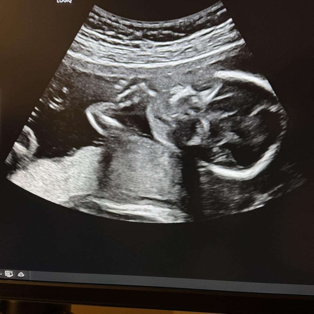 Photo shared by Juliet for their Babylist baby registry.