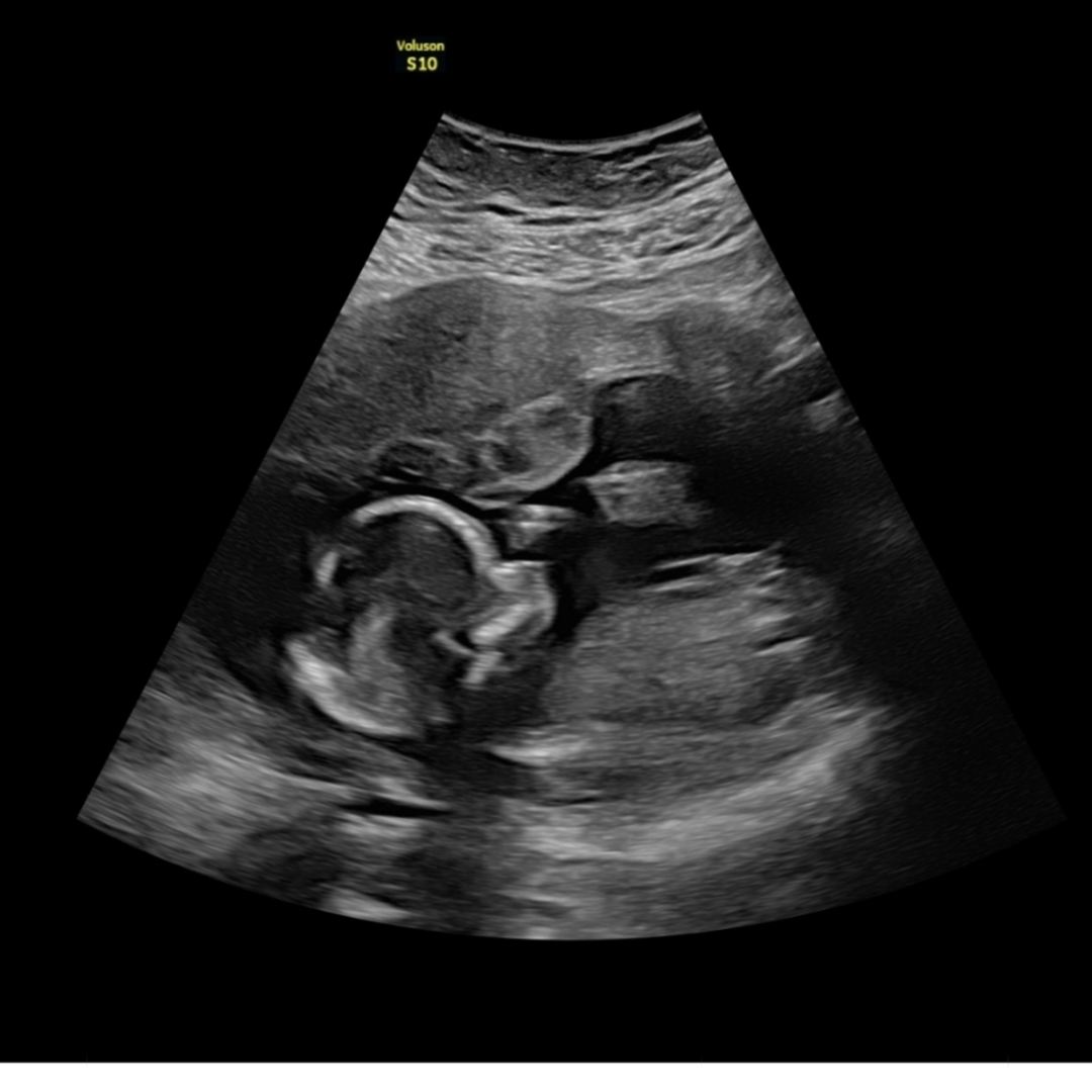 Photo shared by Christa for their Babylist baby registry.
