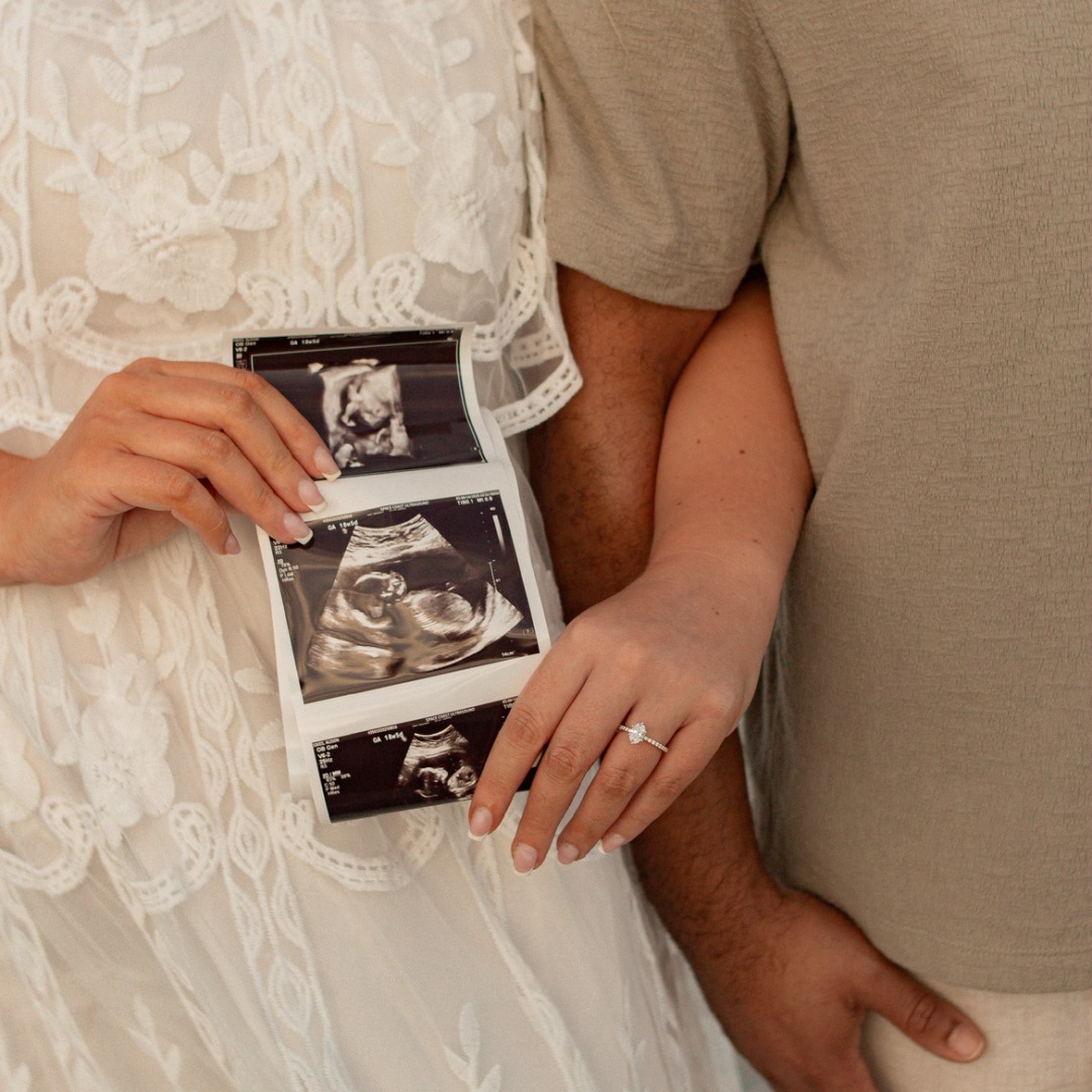 Photo shared by Alison for their Babylist baby registry.