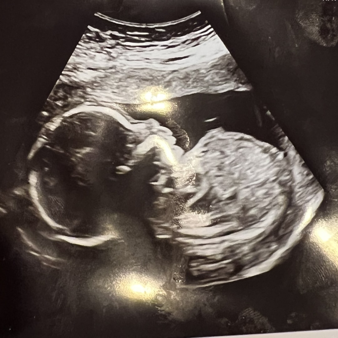 Photo shared by Gabby for their Babylist baby registry.