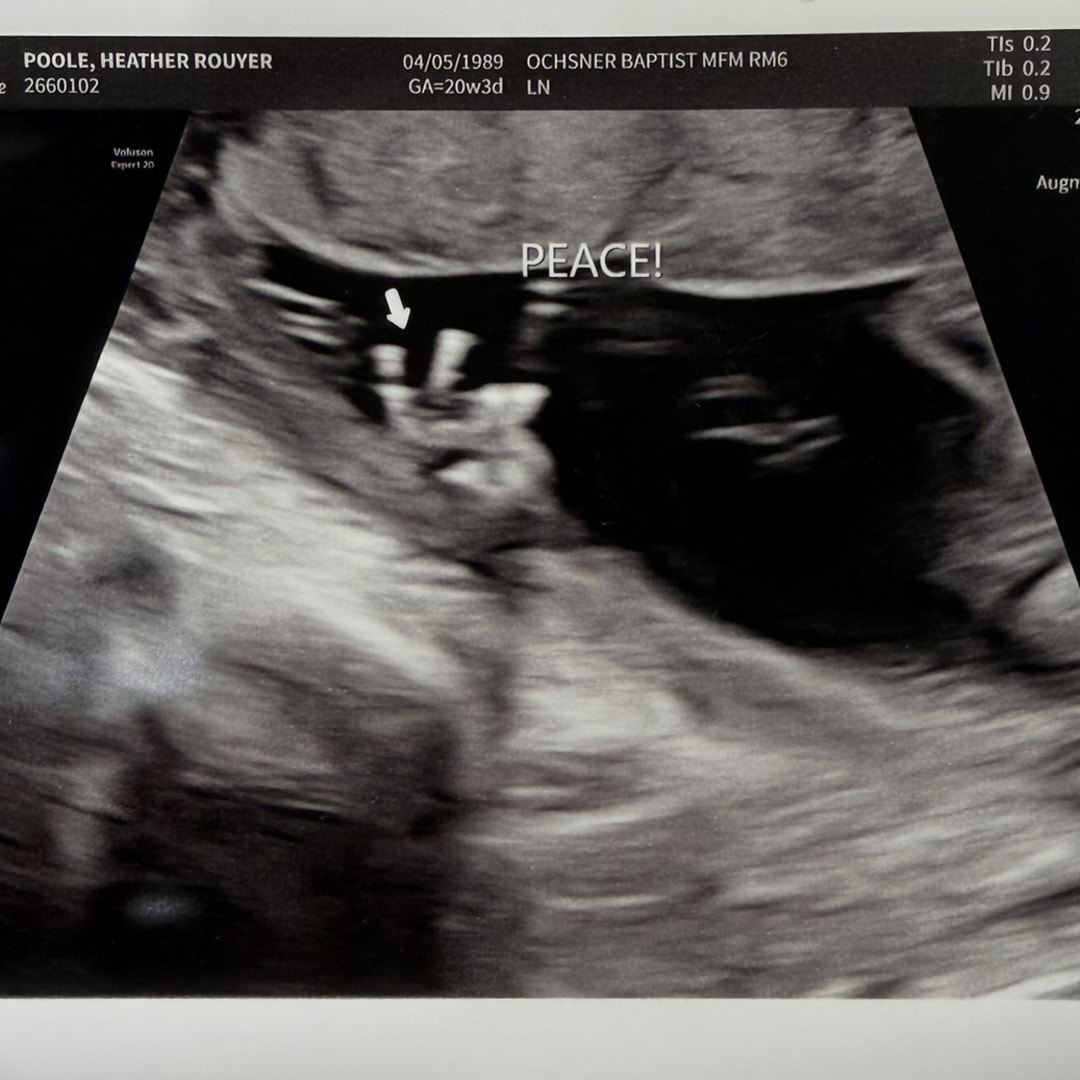 Photo shared by Heather for their Babylist baby registry.