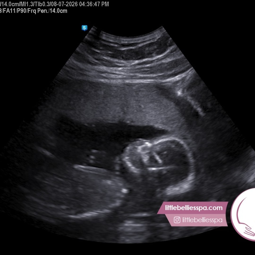 Photo shared by Isabella for their Babylist baby registry.