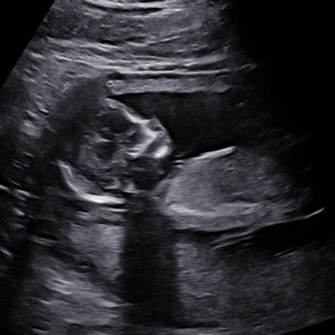 Photo shared by Brianna for their Babylist baby registry.