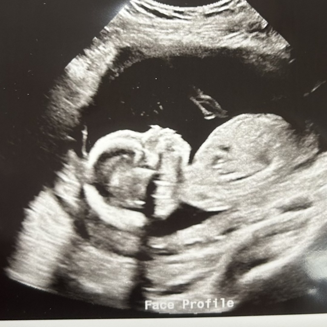 Photo shared by Elizabeth Homola for their Babylist baby registry.