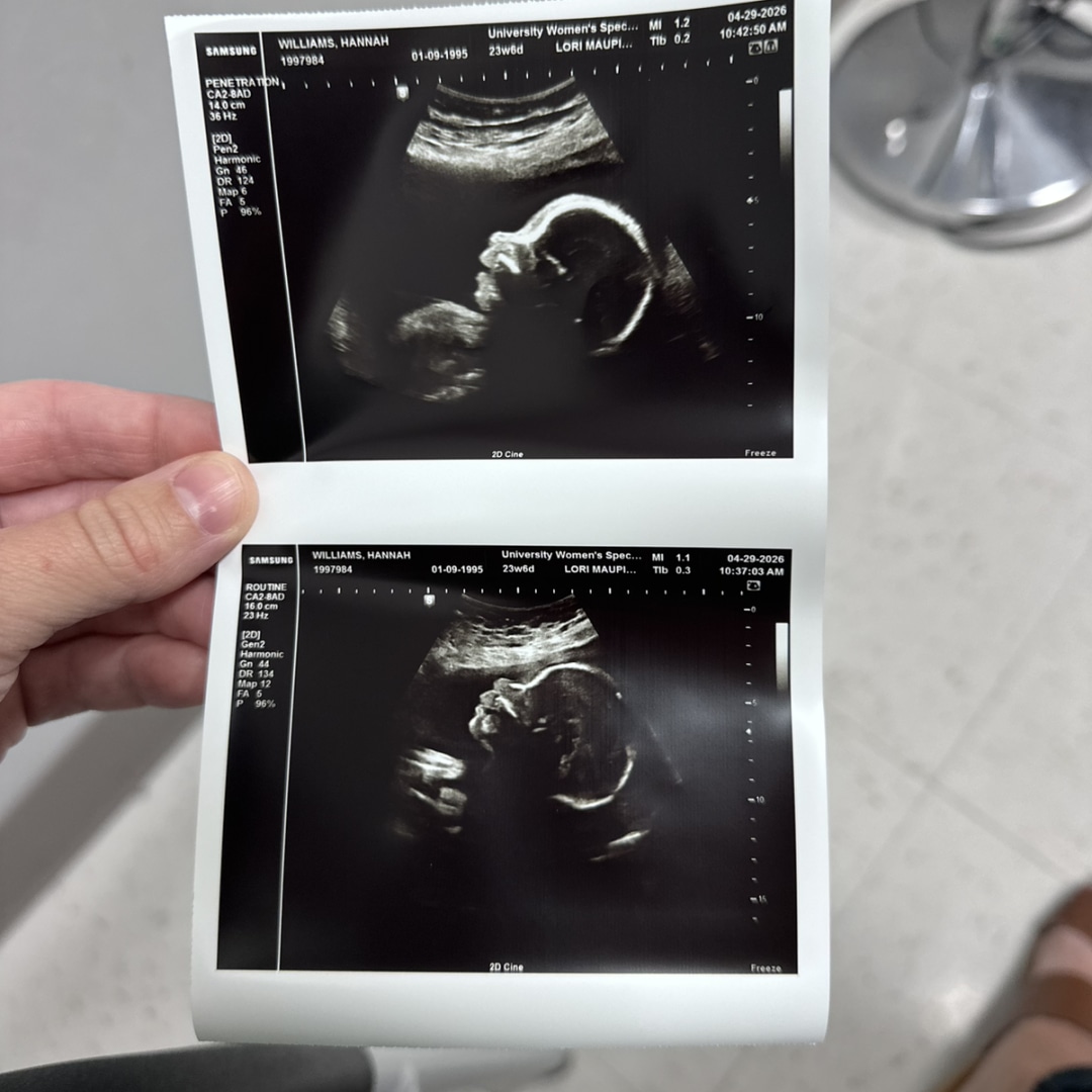 Photo shared by Hannah for their Babylist baby registry.
