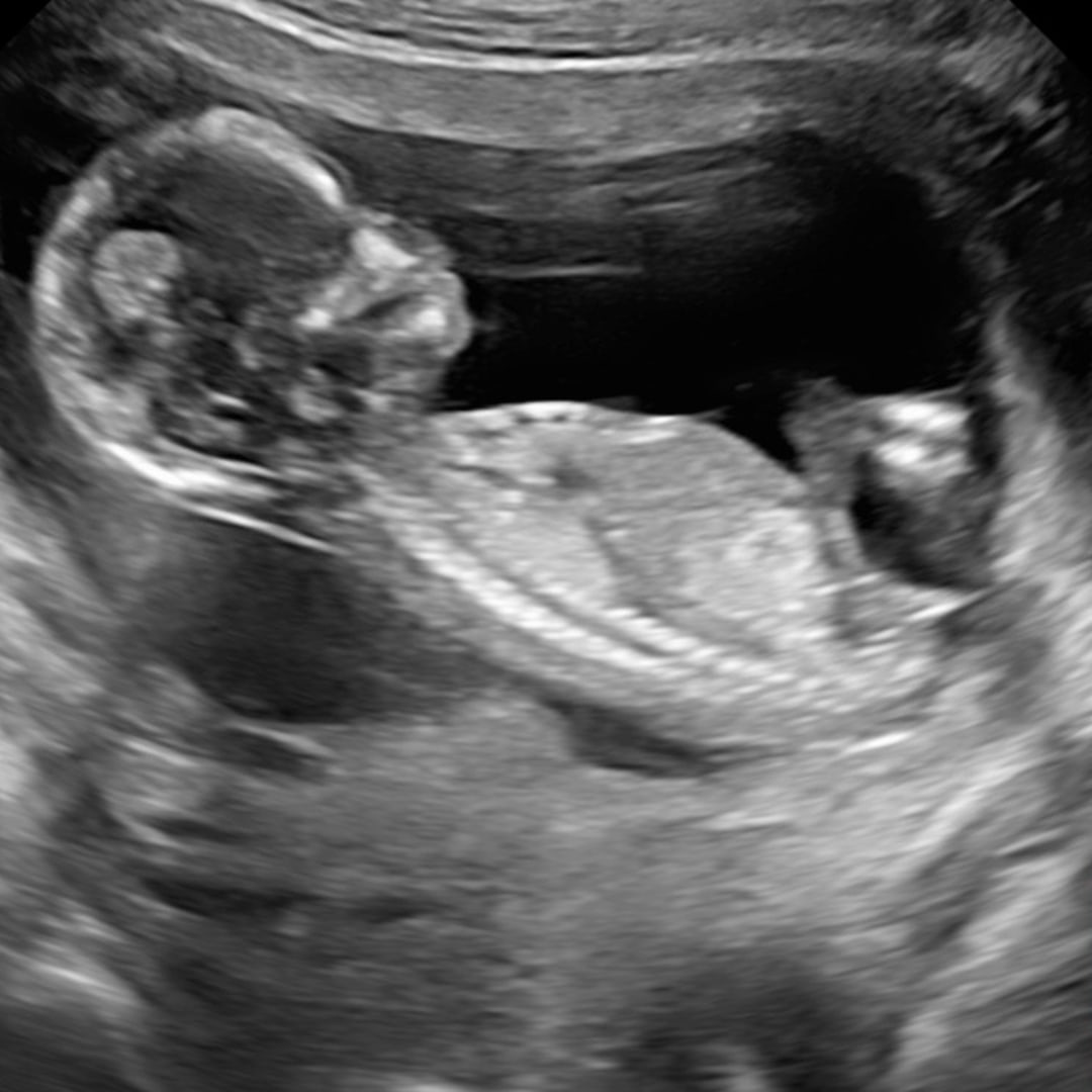 Photo shared by Alexis for their Babylist baby registry.