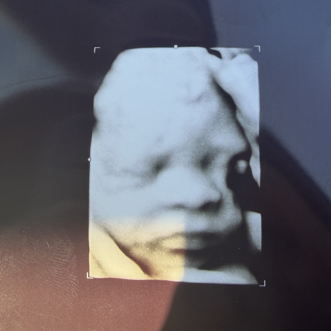 Photo shared by Ciara for their Babylist baby registry.