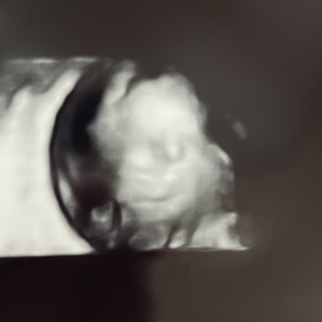Photo shared by Elizabeth for their Babylist baby registry.