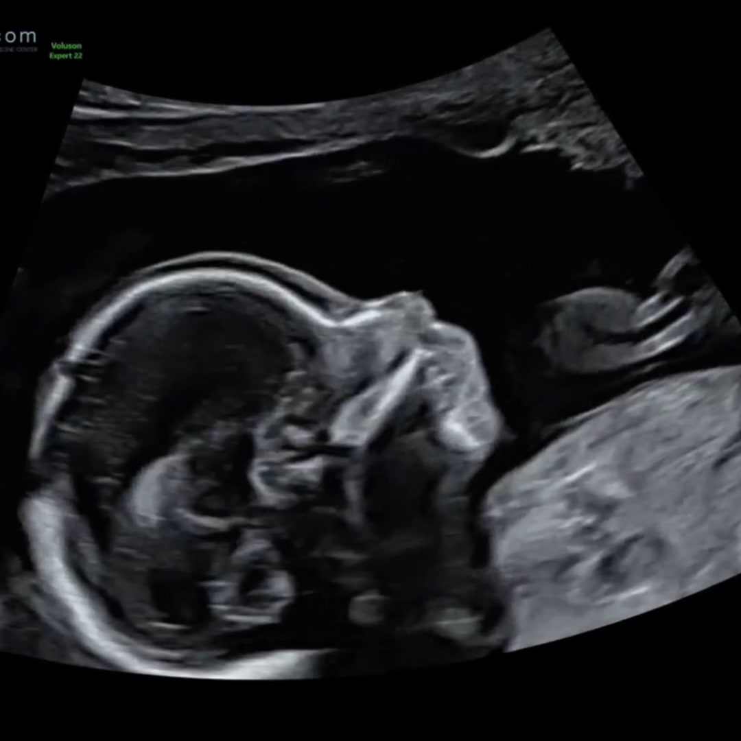 Photo shared by Amanda for their Babylist baby registry.